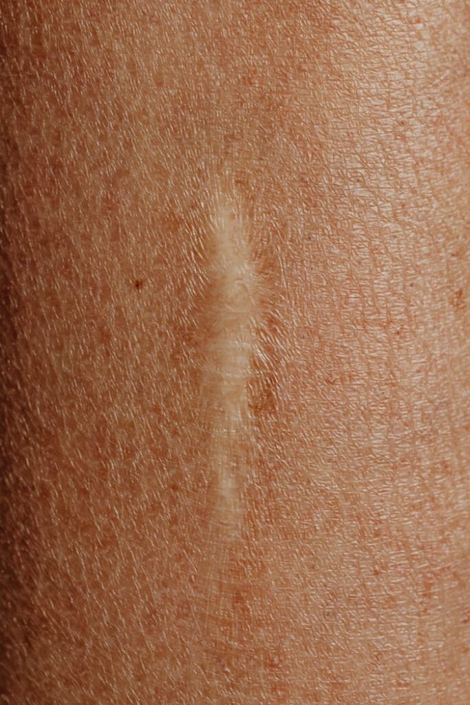 Detailed close-up image of a skin scar, highlighting texture and healing.