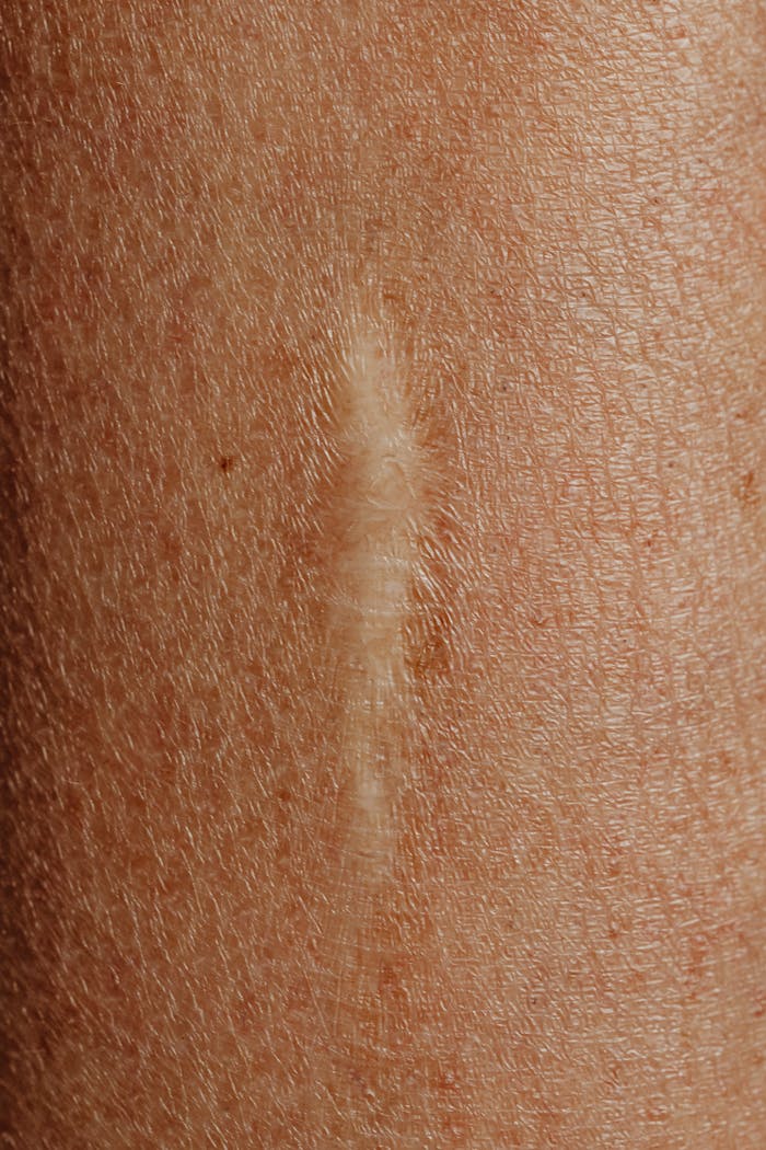 Detailed close-up image of a skin scar, highlighting texture and healing.